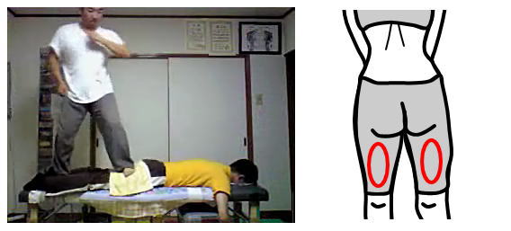 産後骨盤矯正~札幌厚別江別の整体院画像03