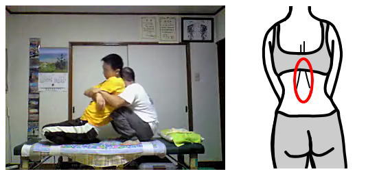 産後骨盤矯正~札幌厚別江別の整体院画像13